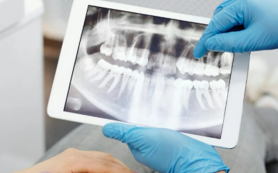 Principal vs. Associate-Led Dental Practices: A Financial Analysis